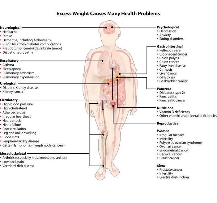 Excessive Weight Casuses Many Health Porblems