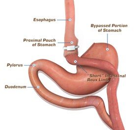 Mesenteric defects & small bowel obstruction